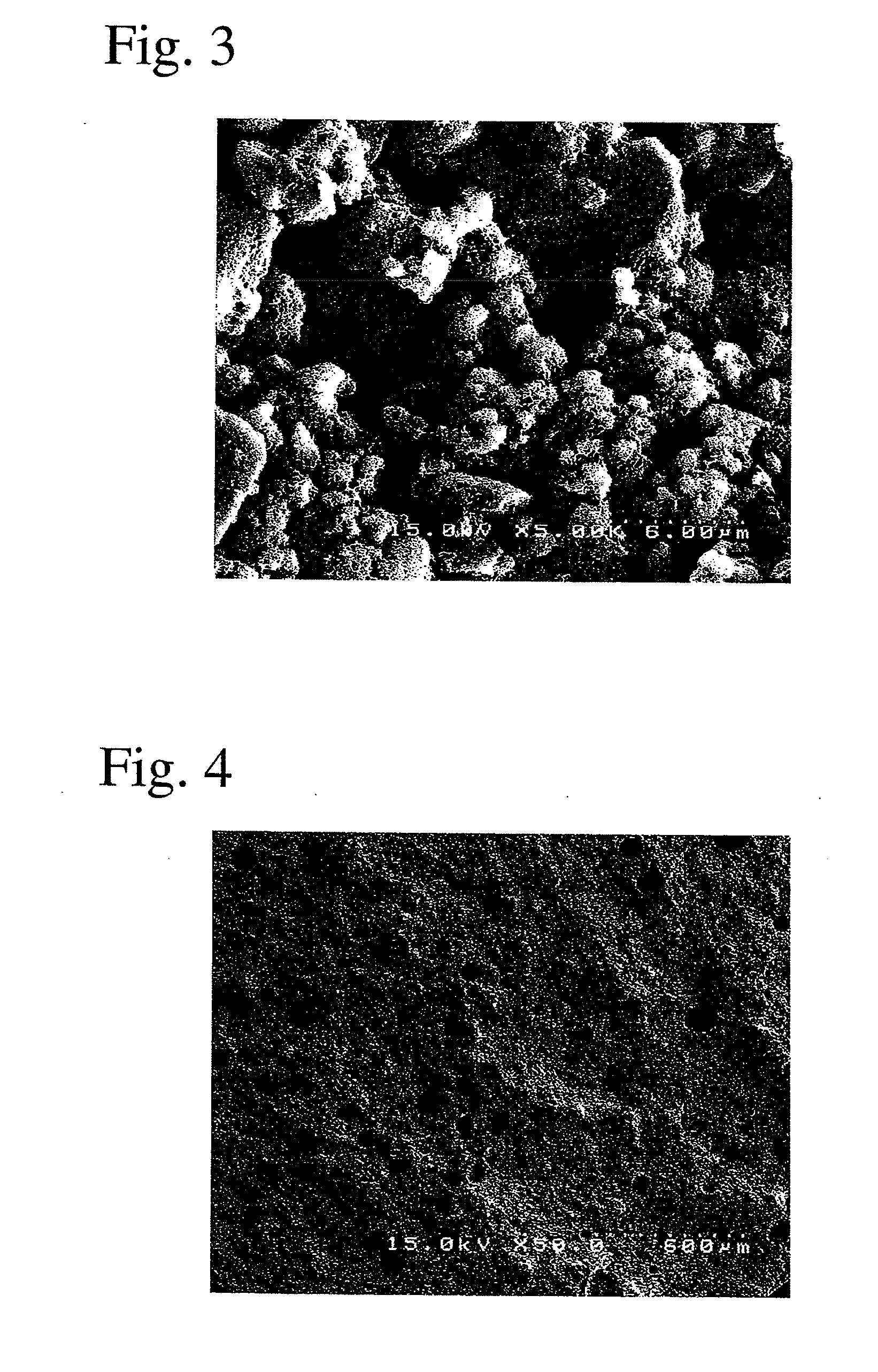 Calcium phosphate cement composition and its kit for bone prosthesis