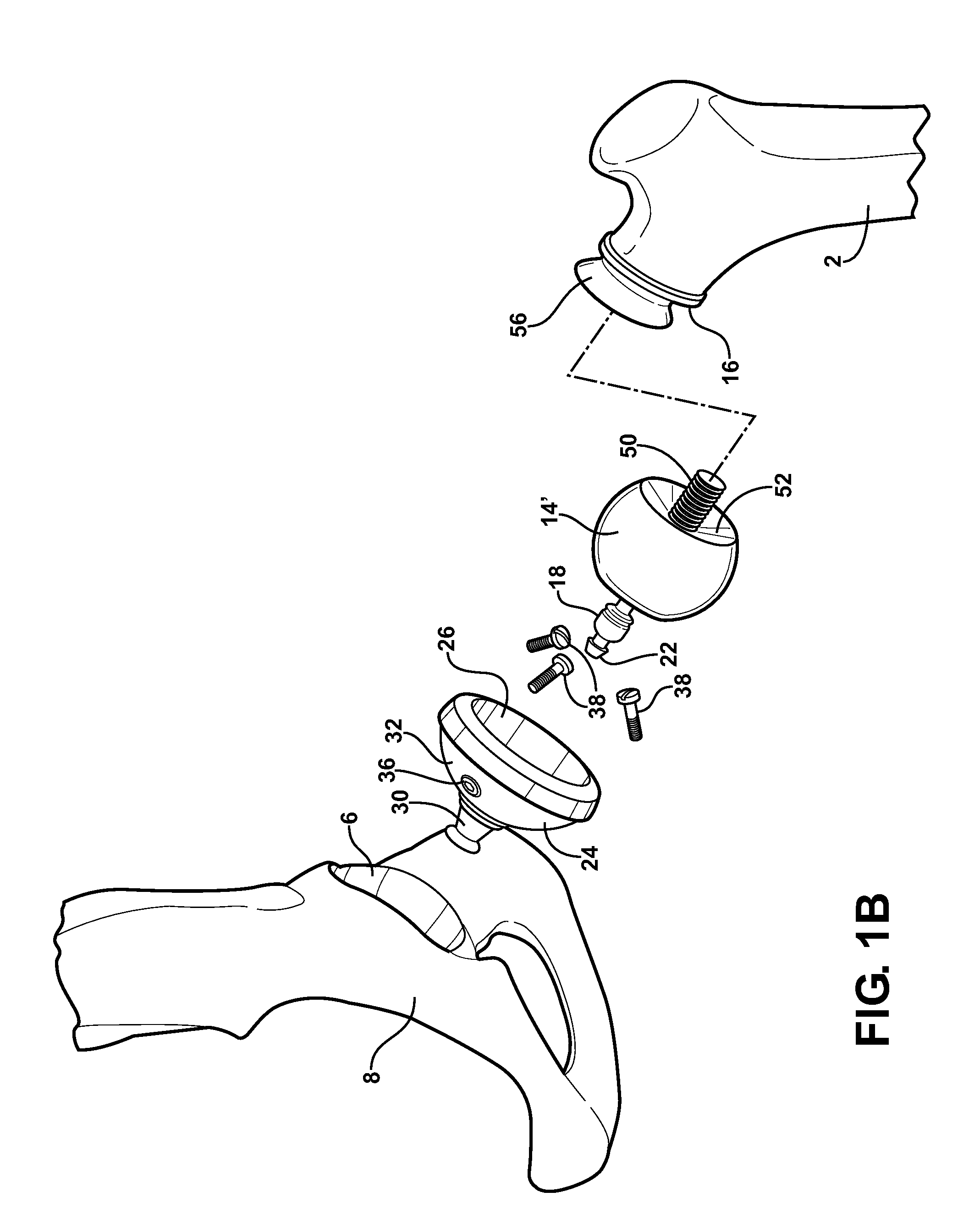 Kit for reconditoning femur and ilium bones in preparation for installation of a joint implant