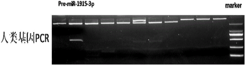 Use of nucleic acid in improving differentiating efficiency of meganucleus of cell