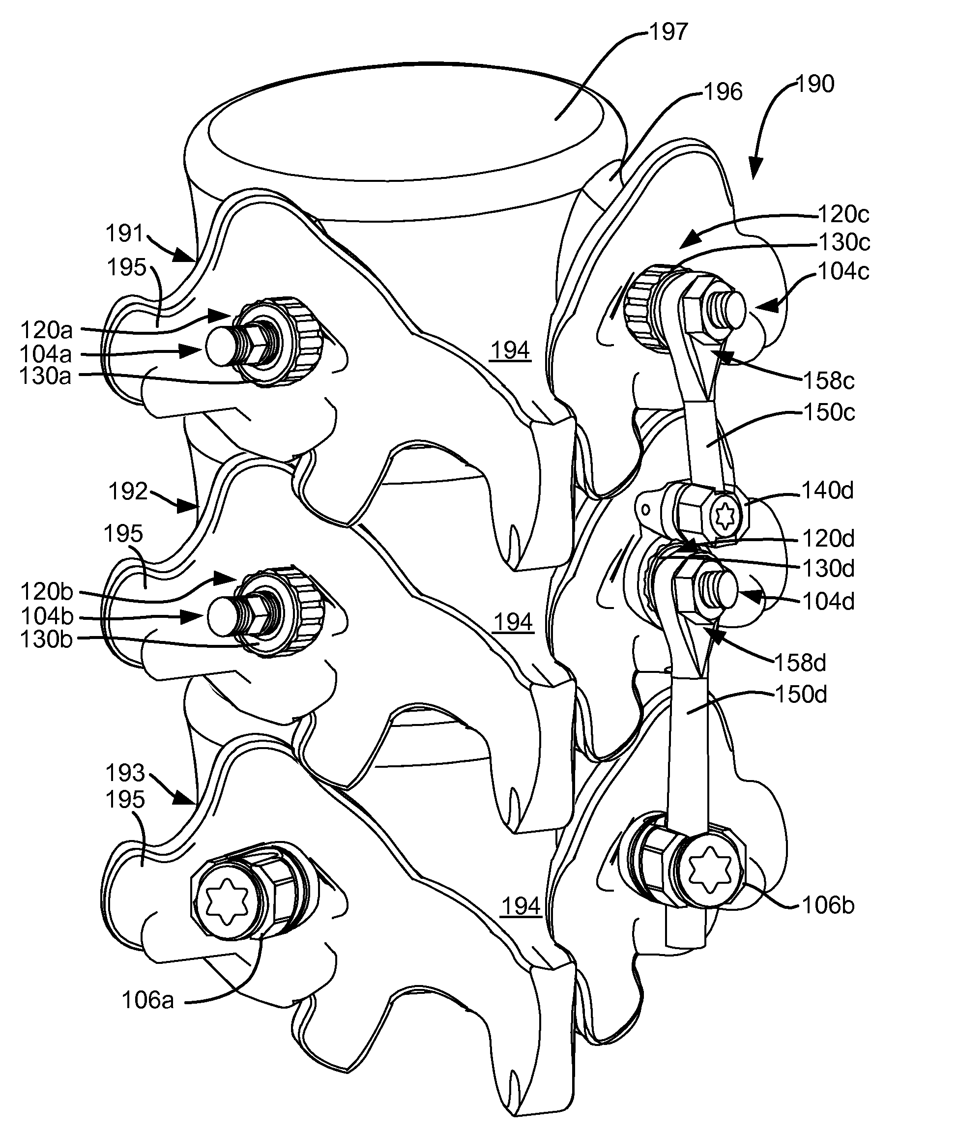 Load-sharing bone anchor having a deflectable post and axial spring and method for dynamic stabilization of the spine