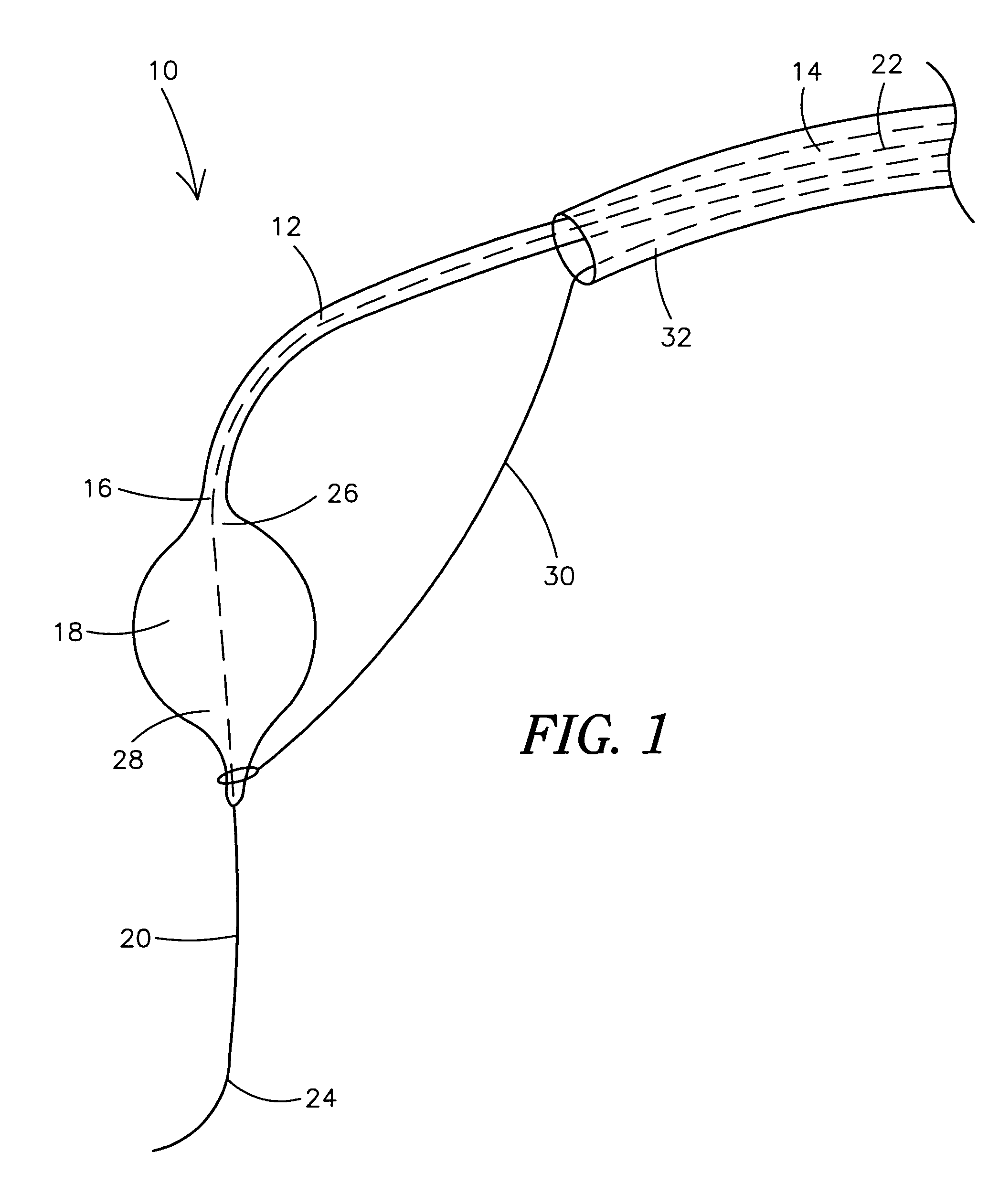 Cryo balloon for atrial ablation