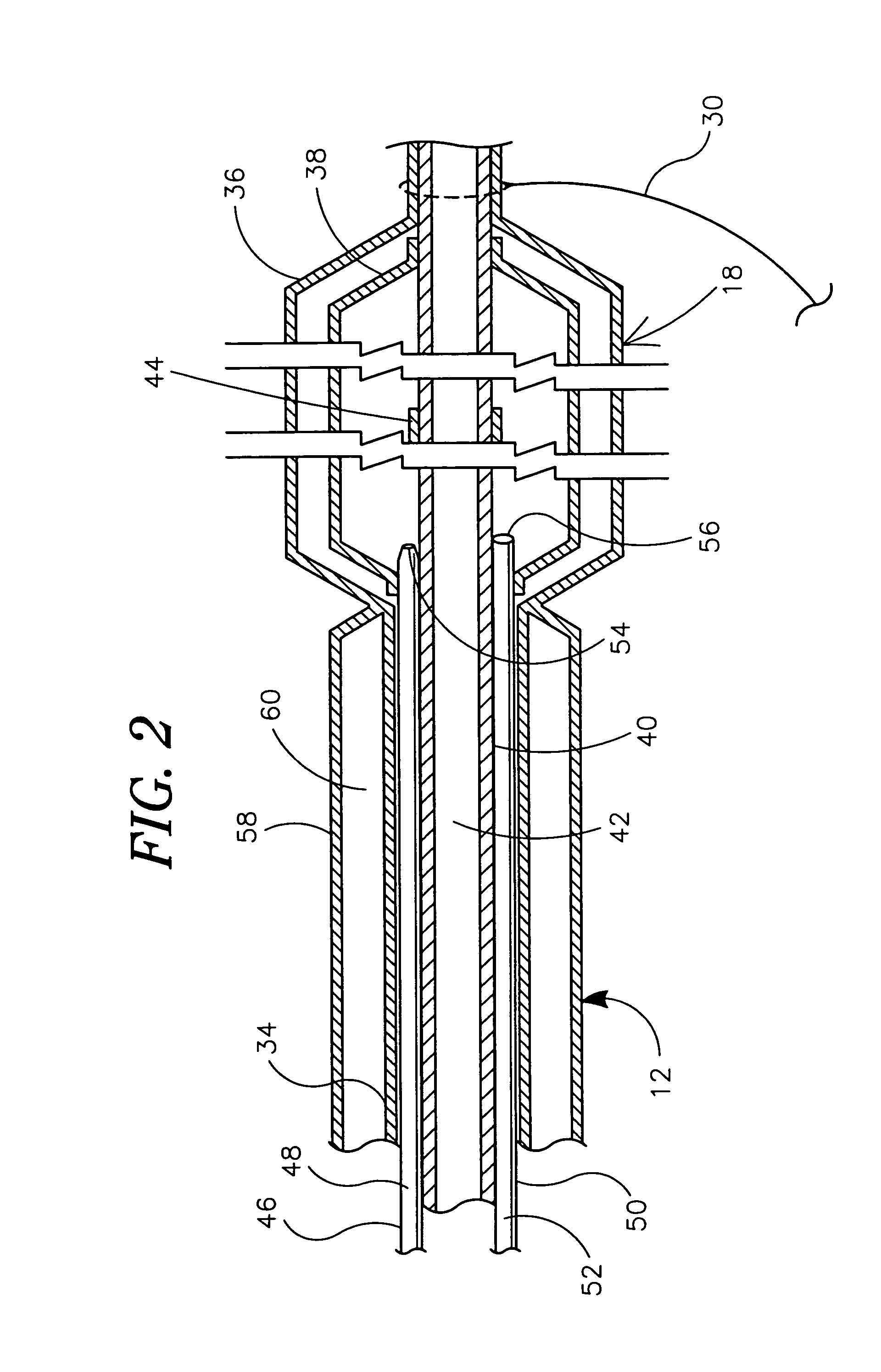 Cryo balloon for atrial ablation