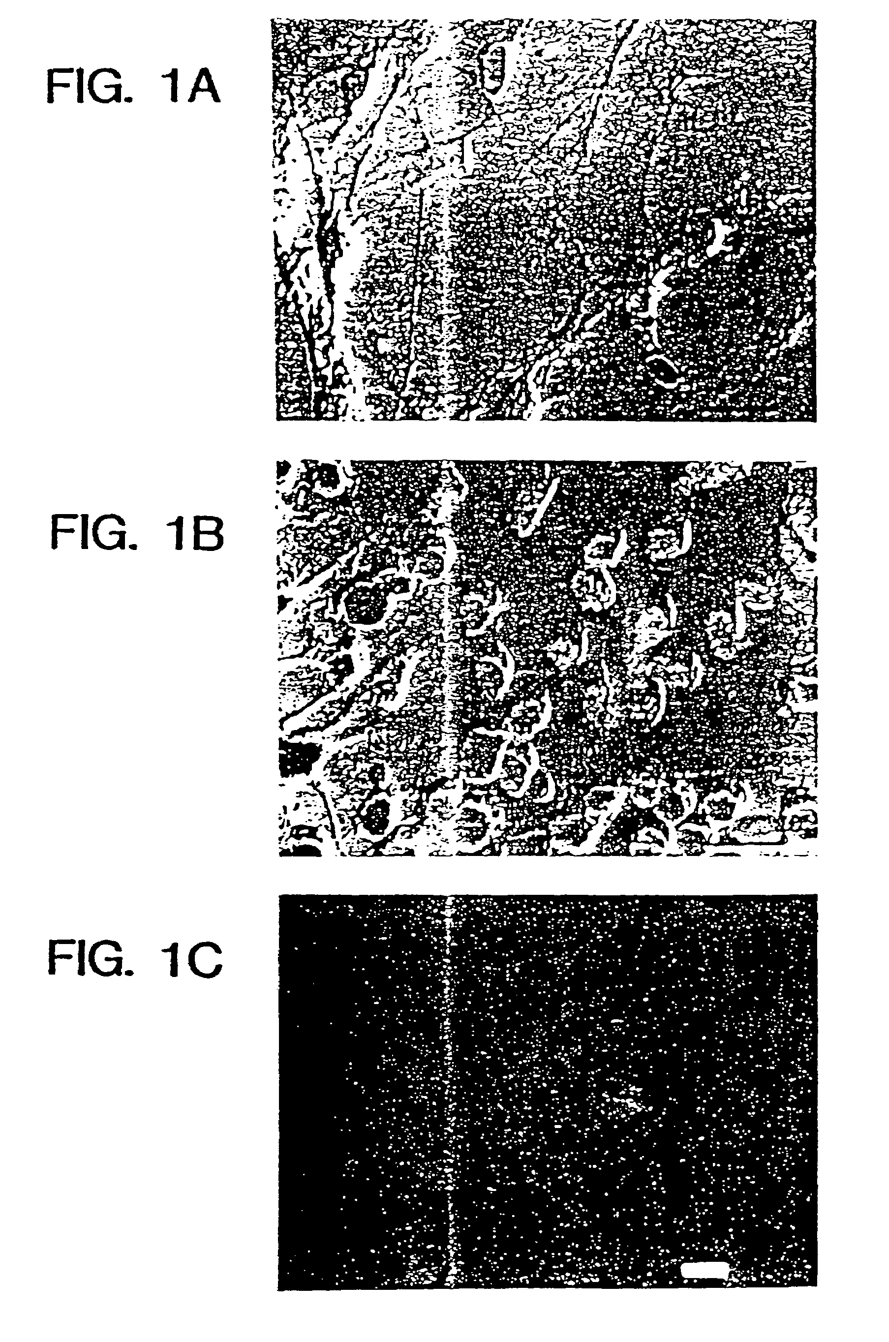 Method for production of neuroblasts