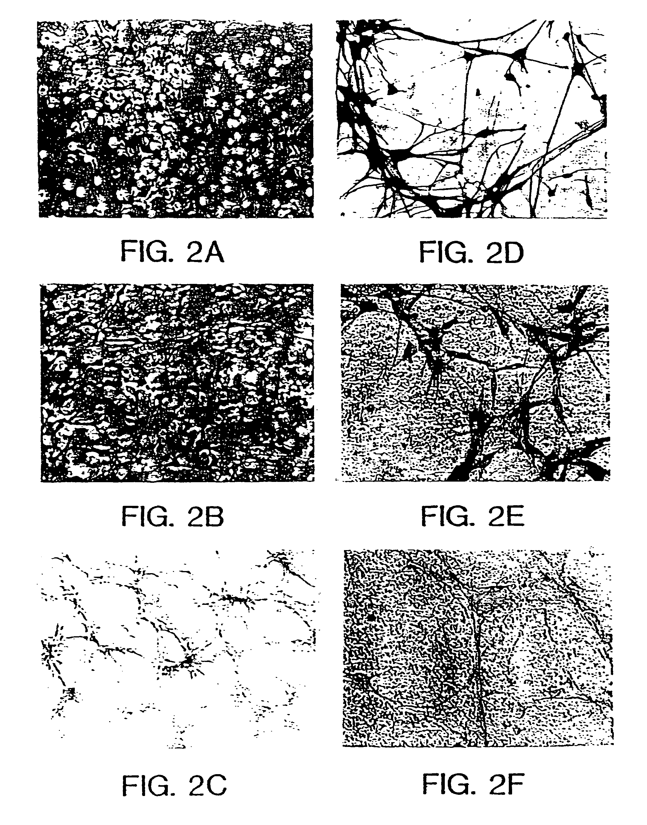 Method for production of neuroblasts