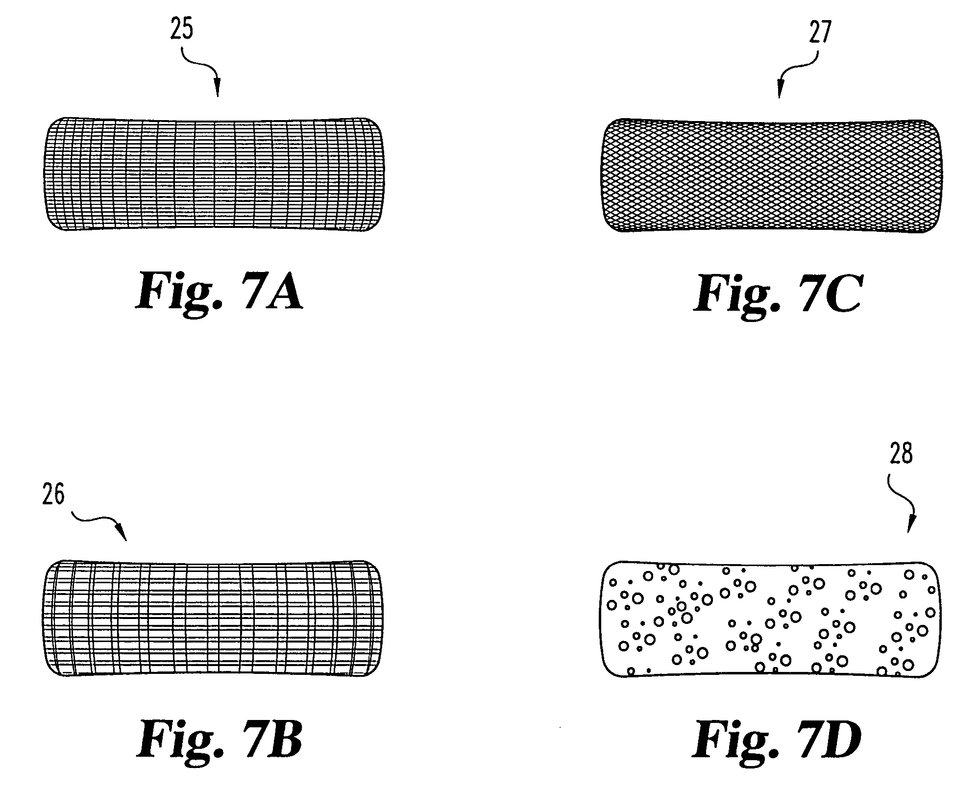 Methods for forming and retaining intervertebral disc implants