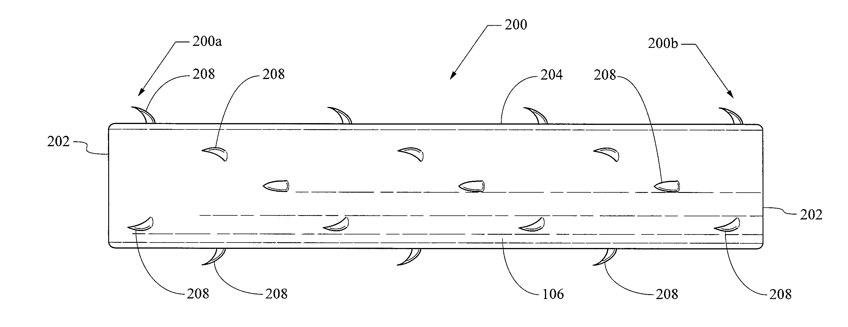 Biodegradable, bioabsorbable stent anchors