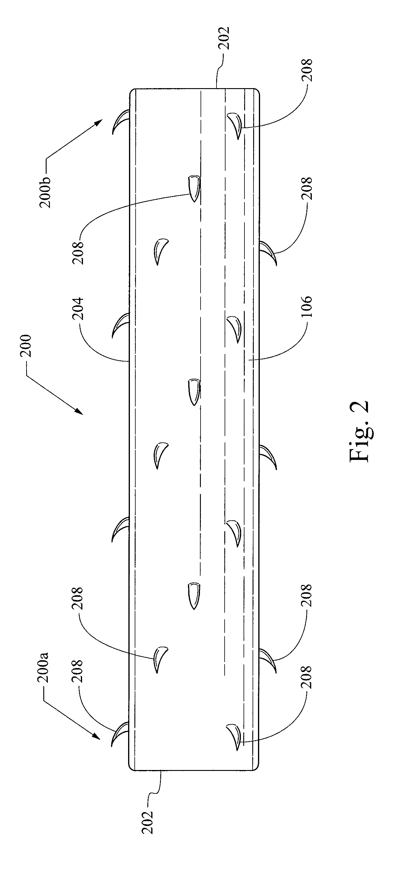 Biodegradable, bioabsorbable stent anchors