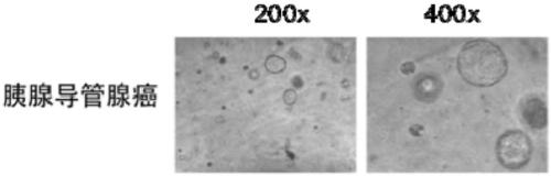 Method for constructing pancreatic cancer cell line by positive expression of Chinese B7-H5