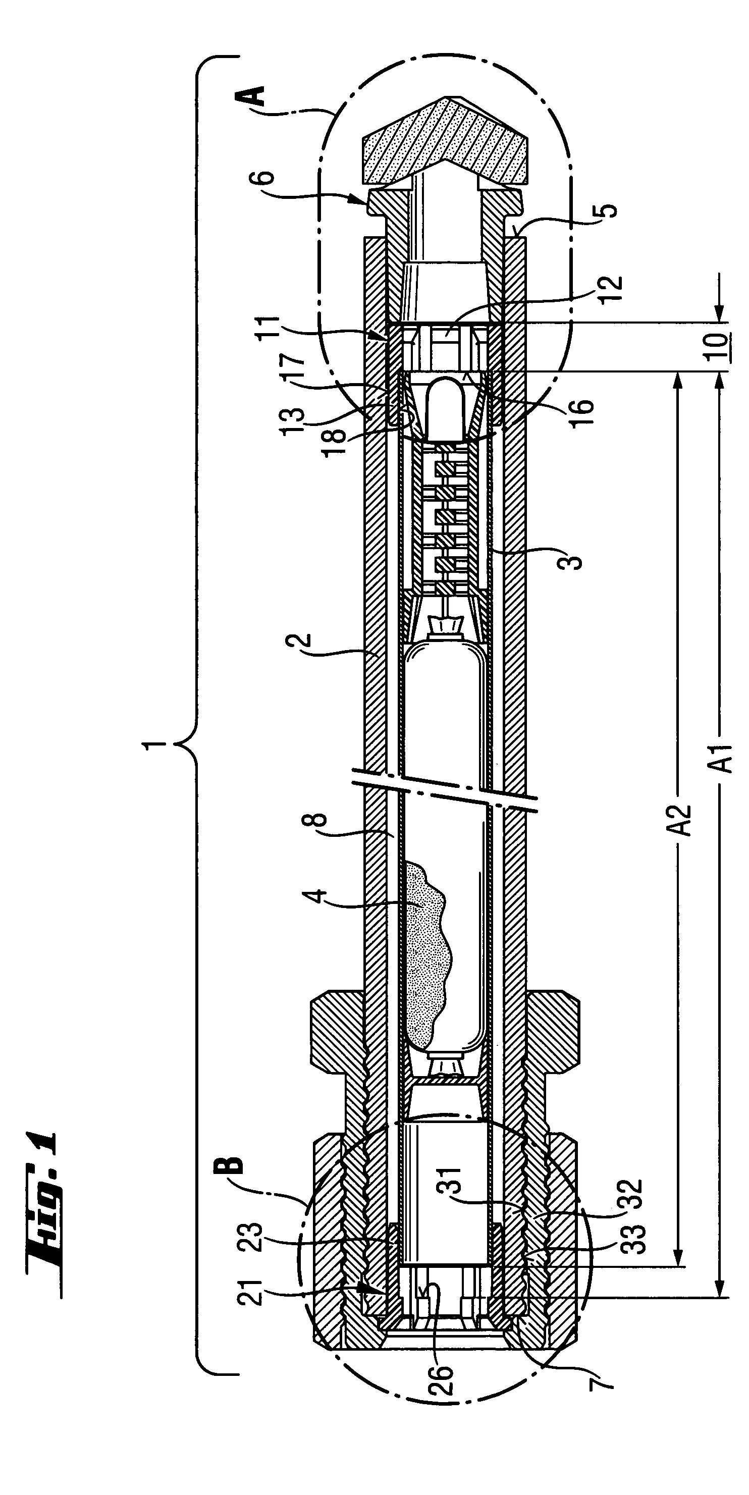 Bonding anchor