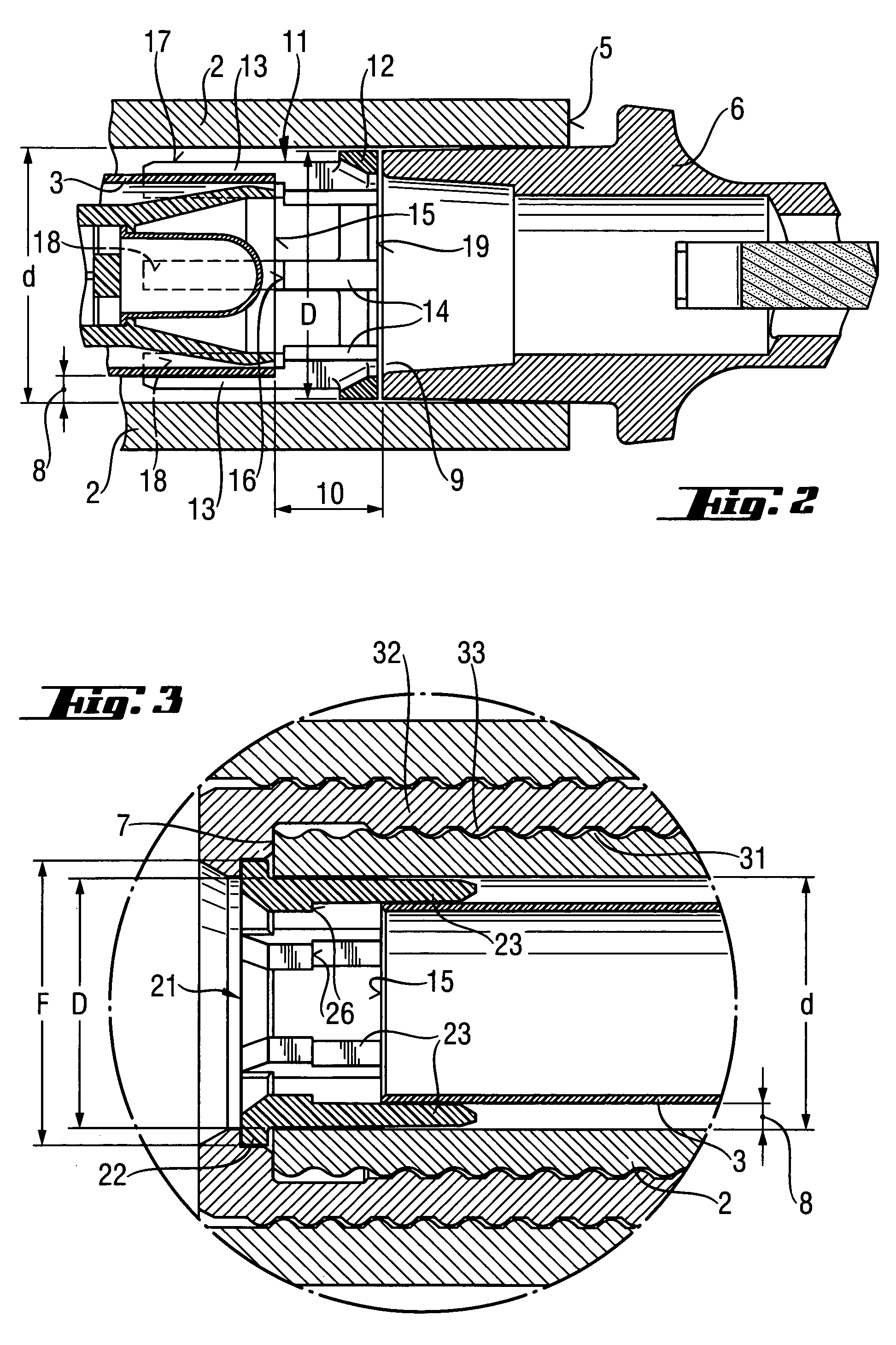 Bonding anchor