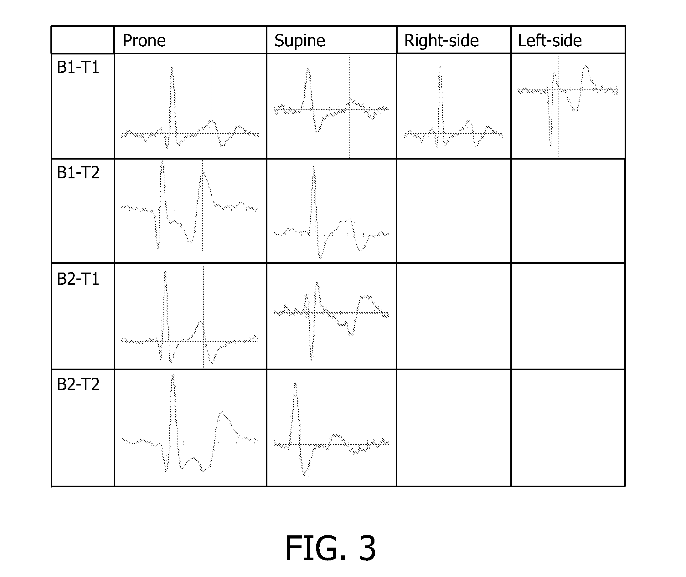 Sleep position detection