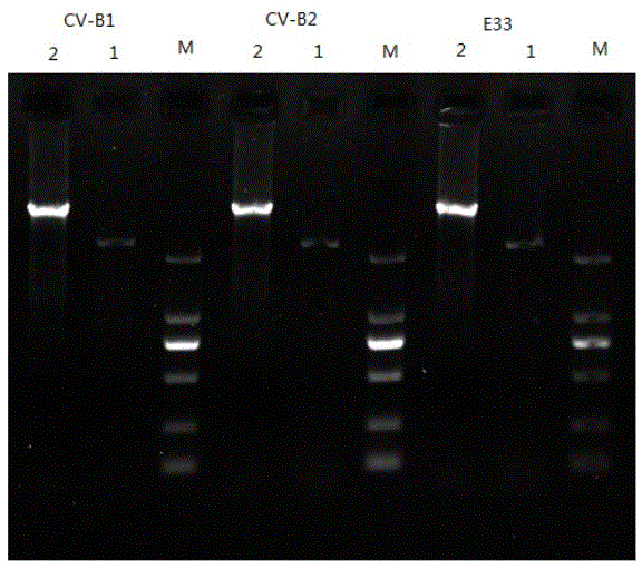 Amplification method for whole genome aiming at different enterovirus serotypes