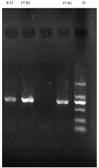 Amplification method for whole genome aiming at different enterovirus serotypes