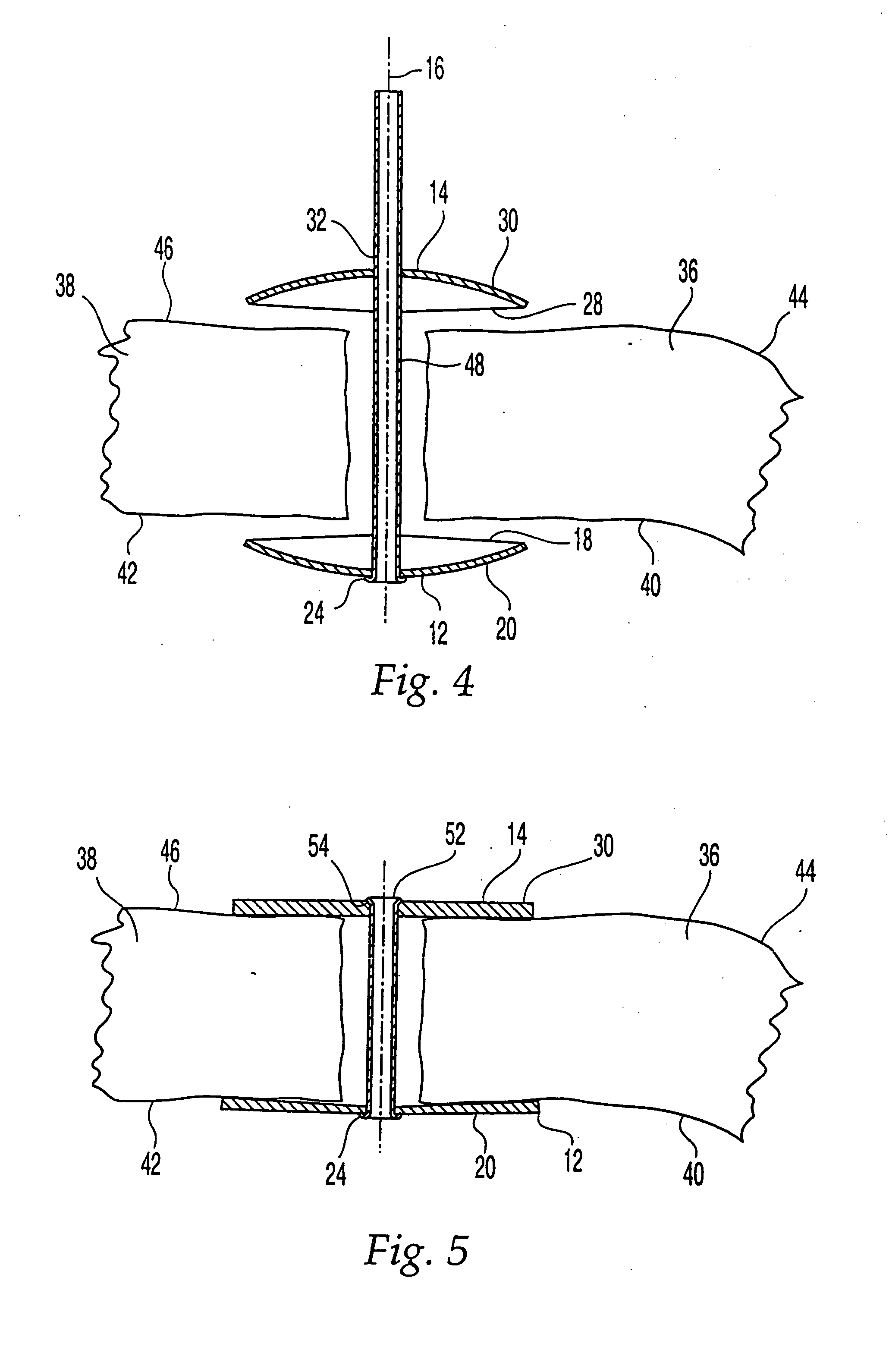 Cranial flap clamp instrument