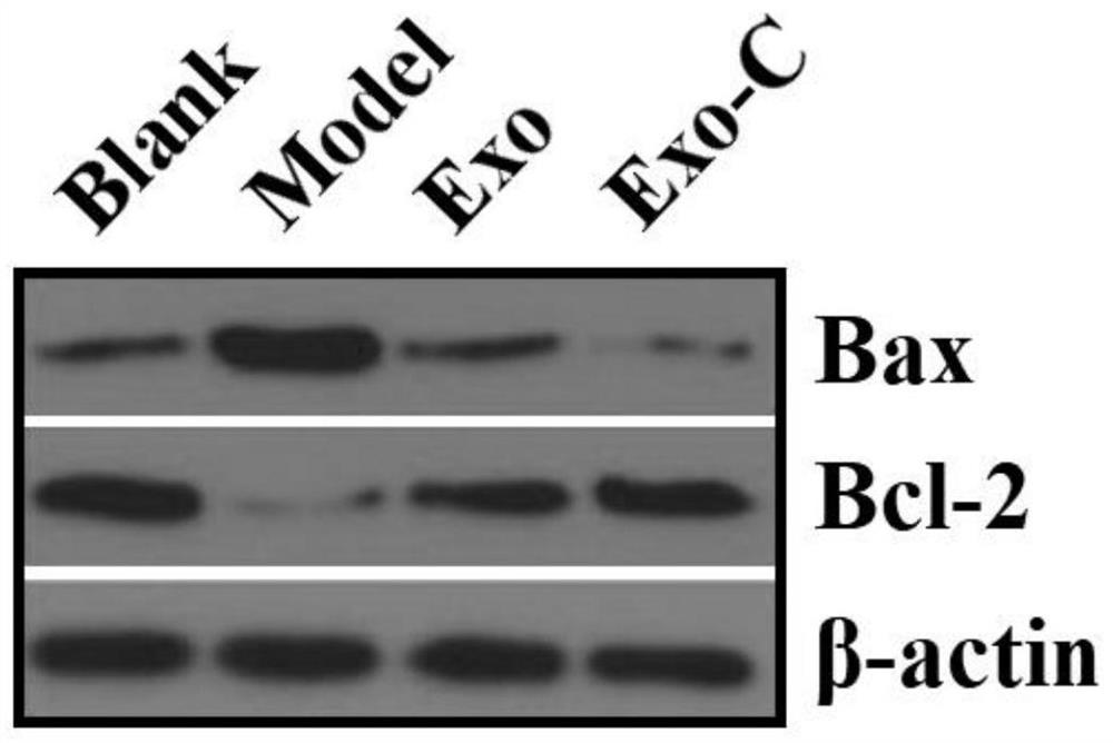 Neural stem cell exosome and application thereof in treating neurodegenerative diseases