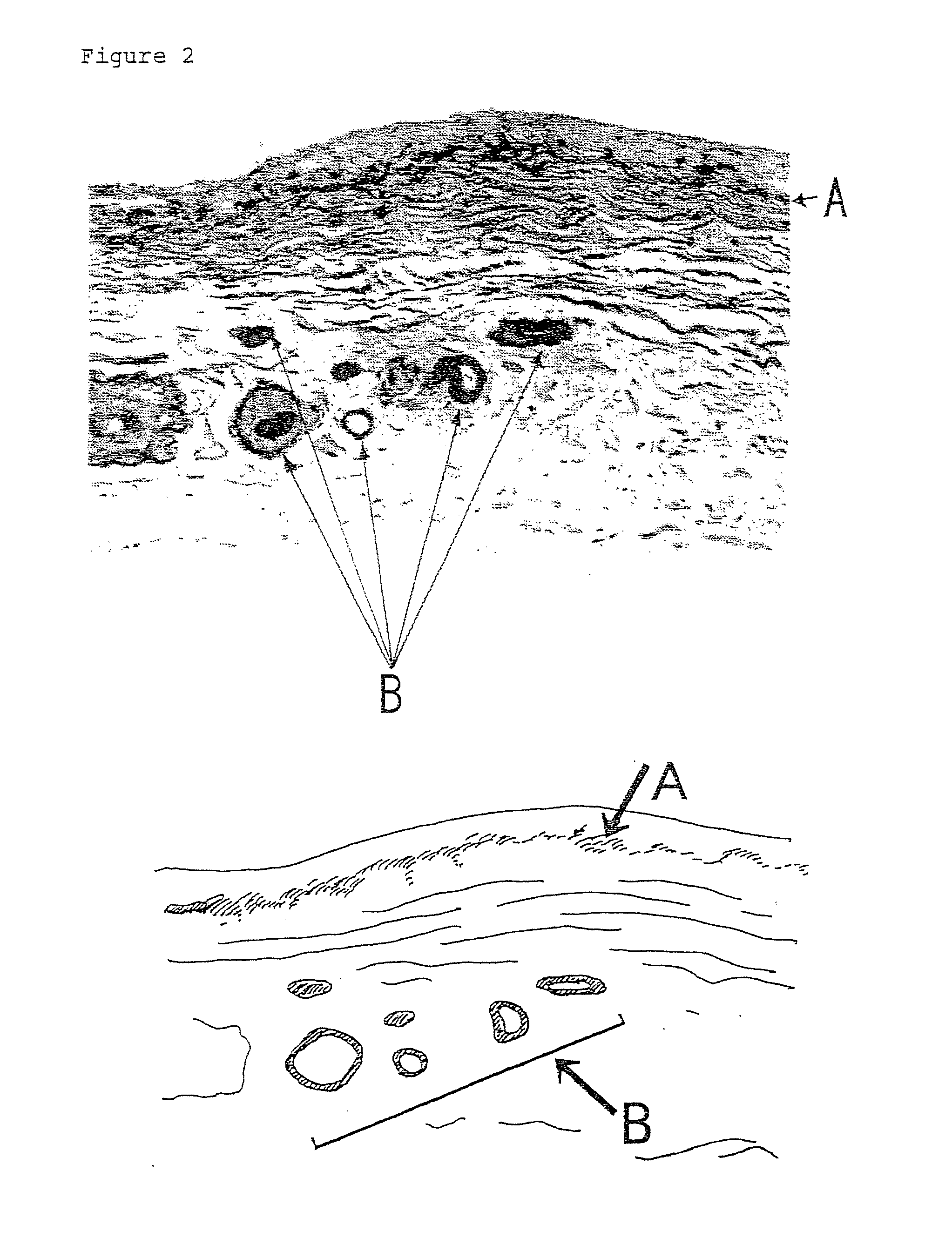 Method for preparing peritoneal dialysate