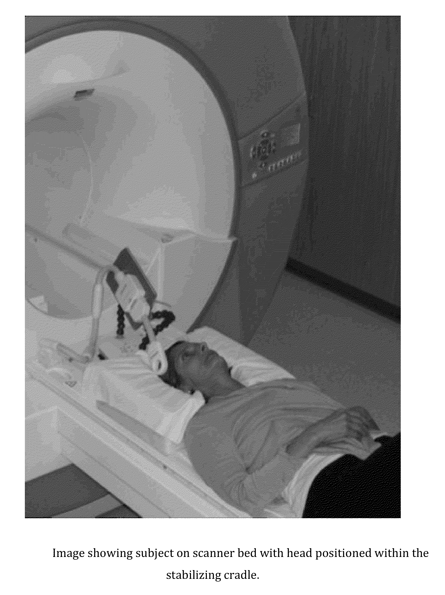 Magnetic Resonance Based Method for Assessing Alzheimer's Disease and Related Pathologies