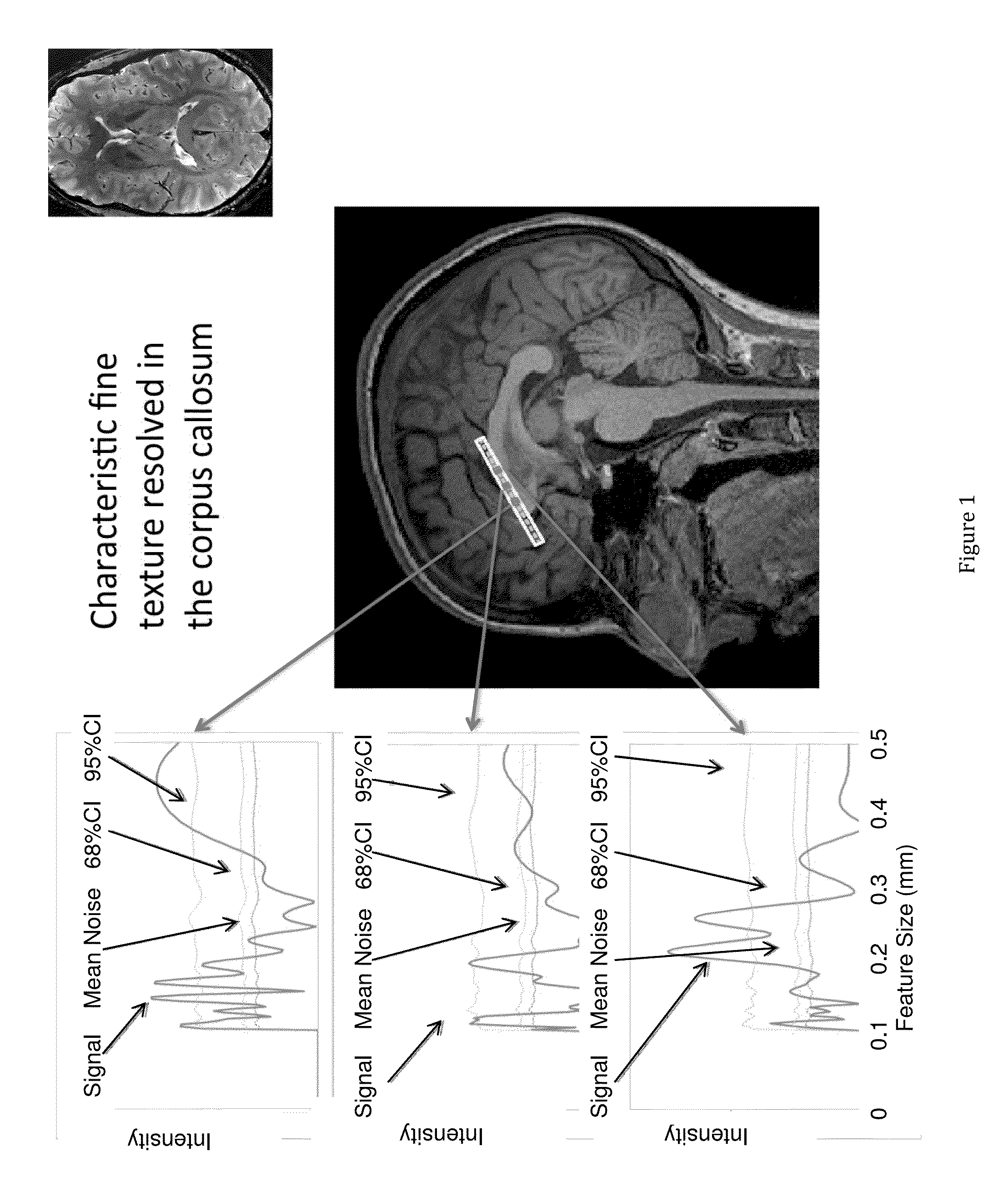 Magnetic Resonance Based Method for Assessing Alzheimer's Disease and Related Pathologies