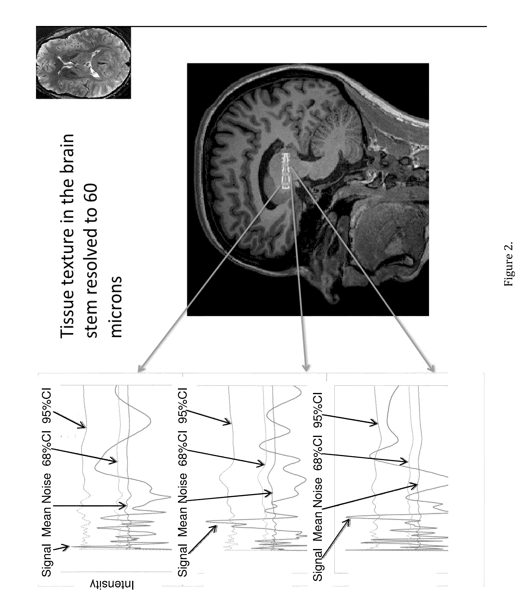 Magnetic Resonance Based Method for Assessing Alzheimer's Disease and Related Pathologies