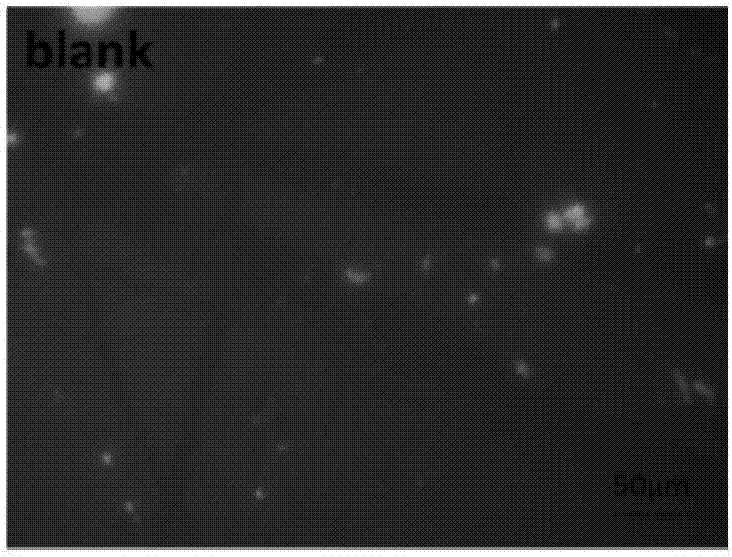 Preparation method of hemostatic material based on fibrin gel