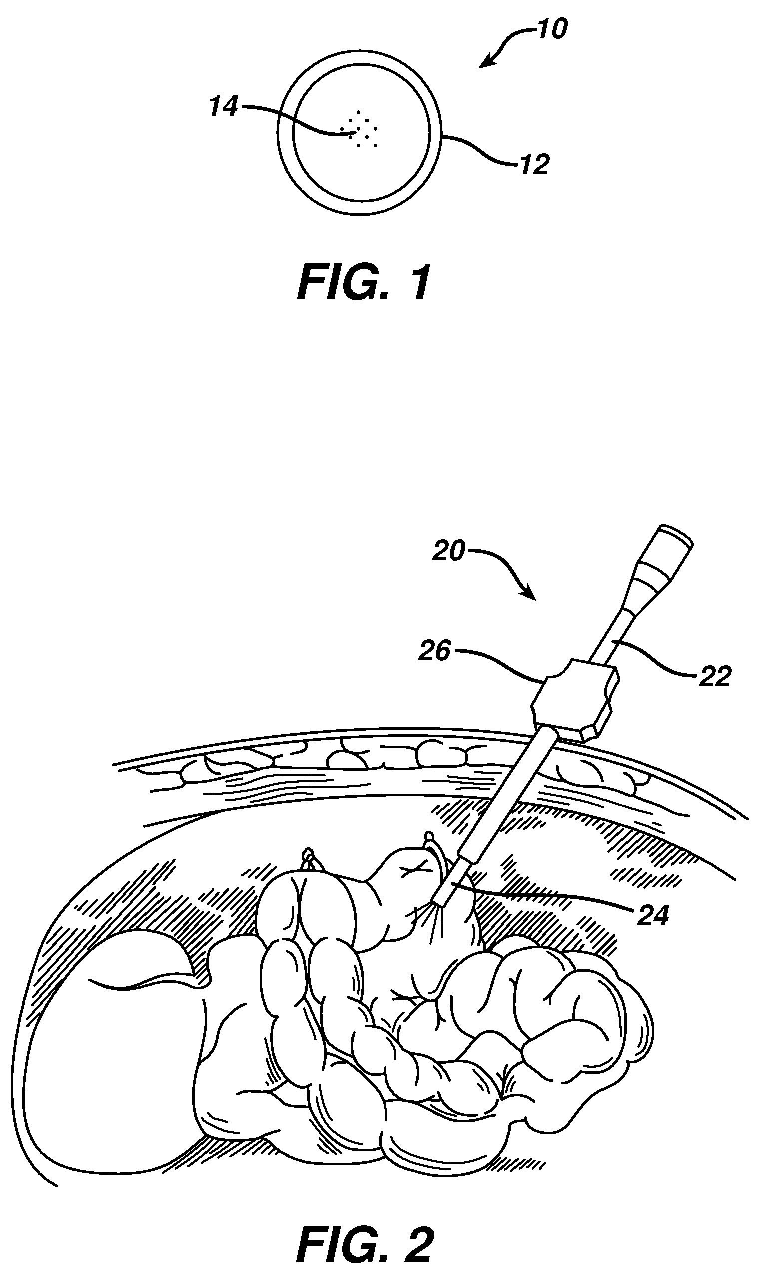 Biocompatible nanoparticle compositions and methods