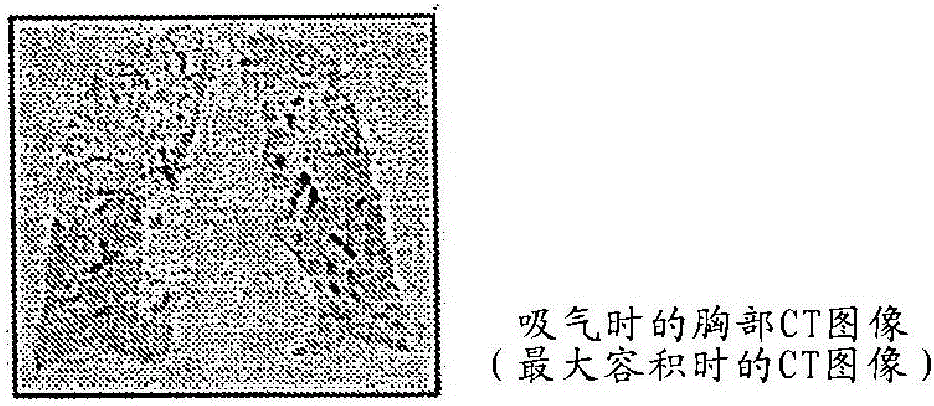 Medical image processing apparatus and medical image processing method