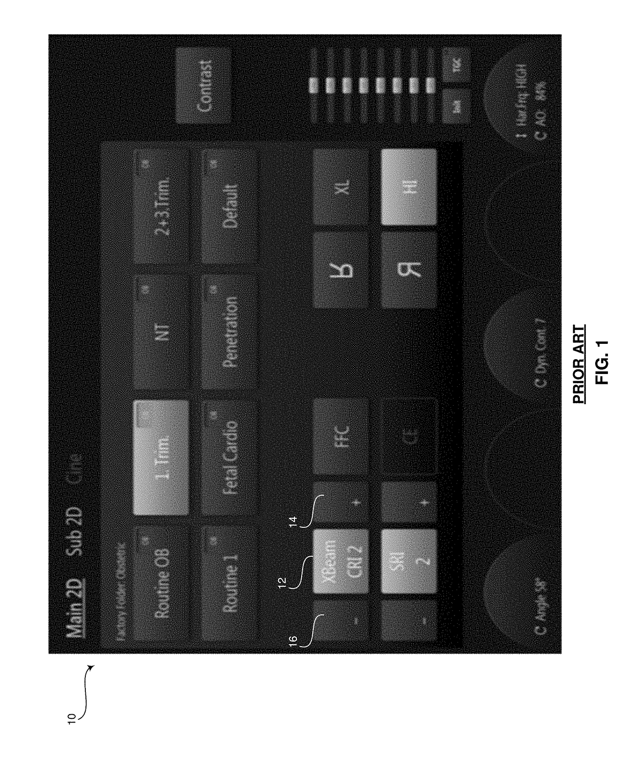 Method and system for synchronously manipulating interdependent medical device operating parameters on a touchscreen device