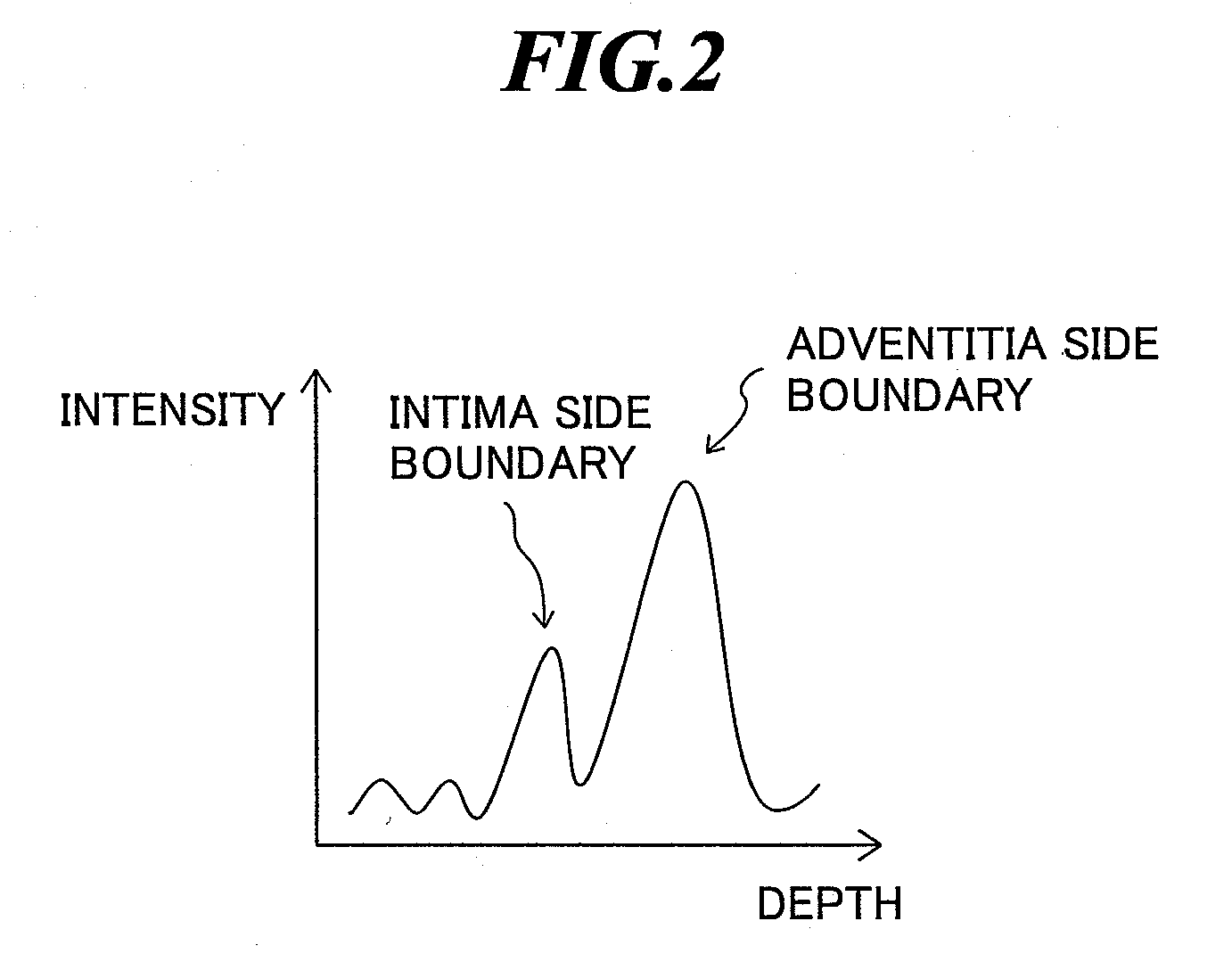 Ultrasonic diagnostic apparatus, imt measurement method, and imt measurement program