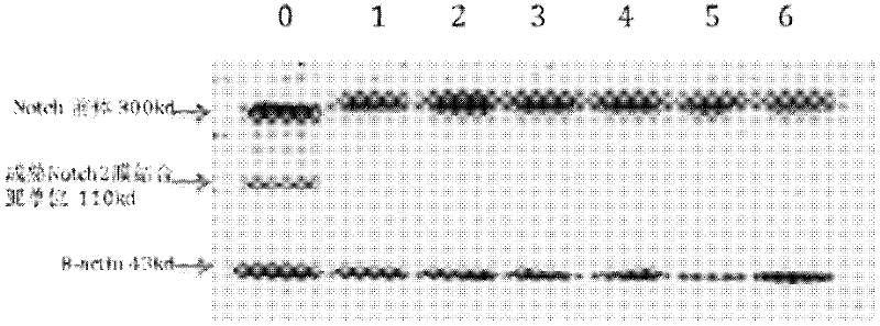 Application of epigallocatechin gallate