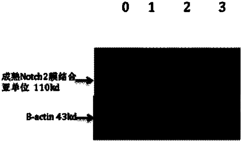 Application of epigallocatechin gallate