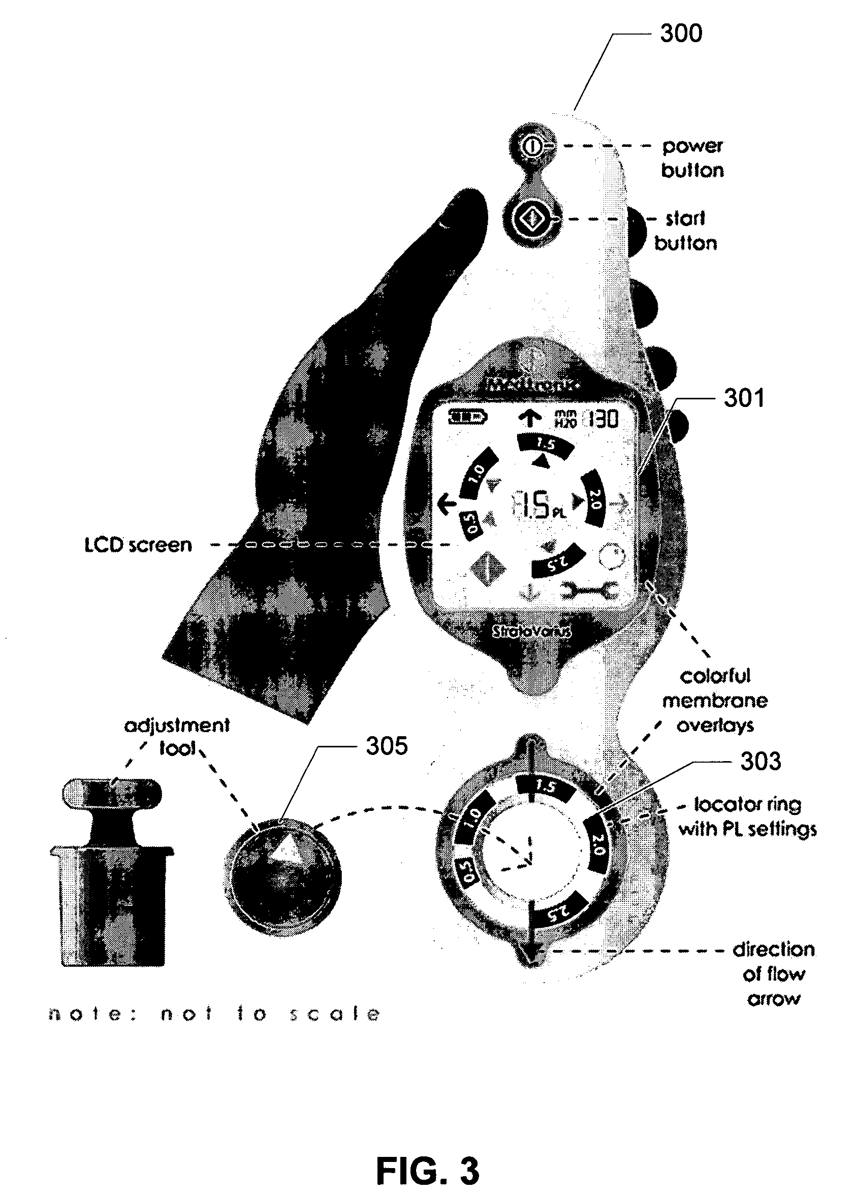 Electronic valve reader