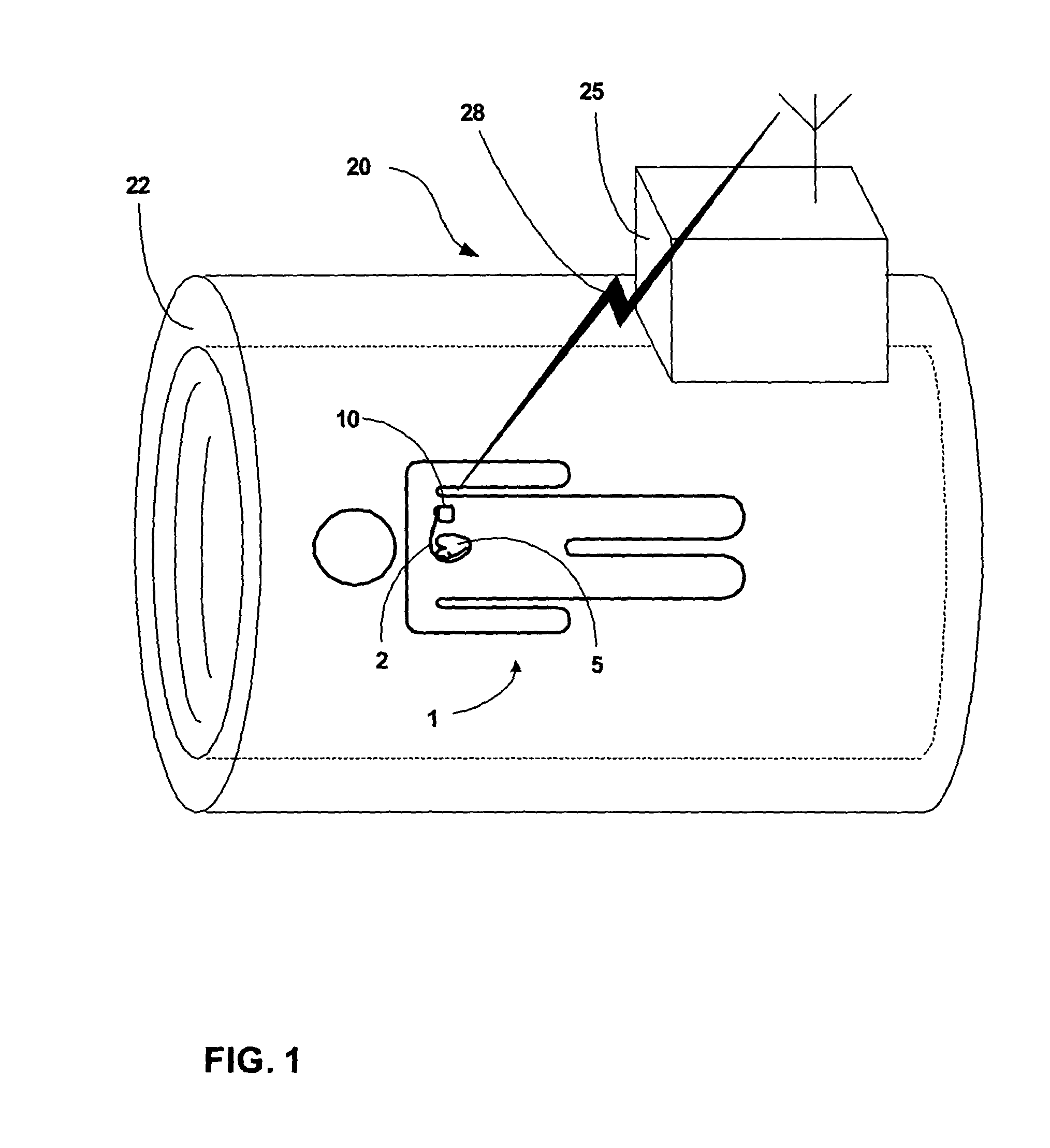 Controlling blanking during magnetic resonance imaging