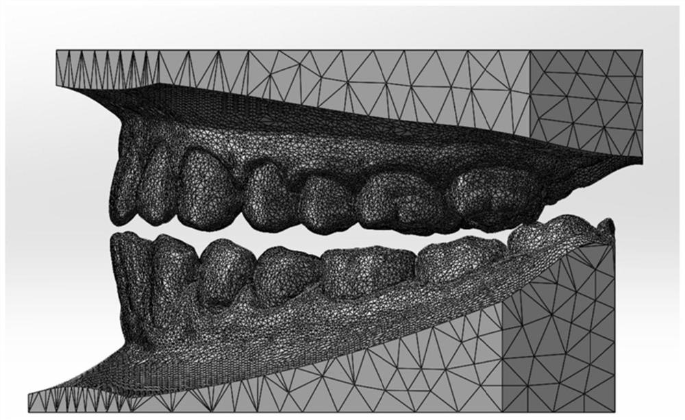 Dentition meshing stress index measurement and occlusion function pre-evaluation system and method