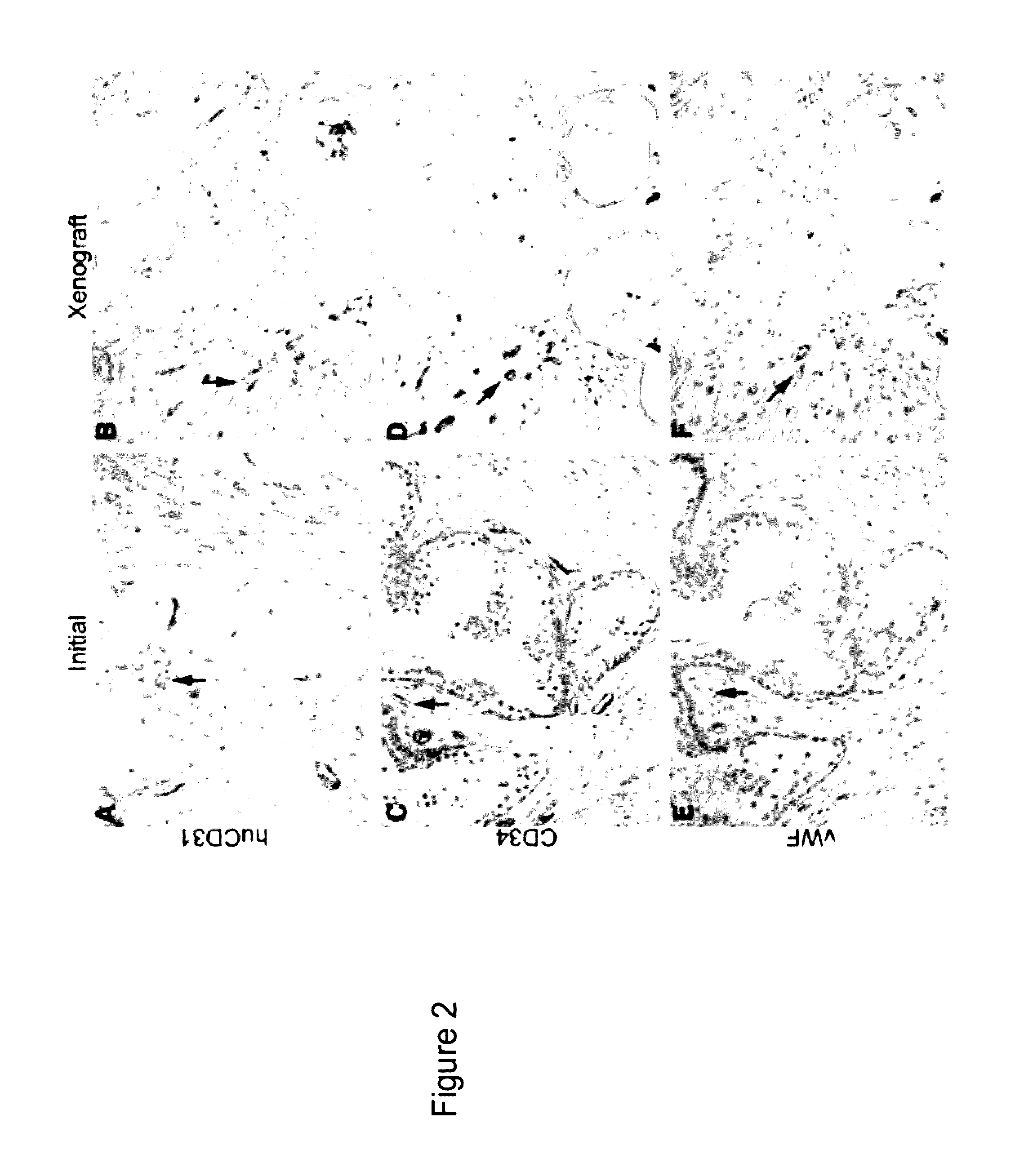 Methods for evaluating and implementing prostate disease treatments