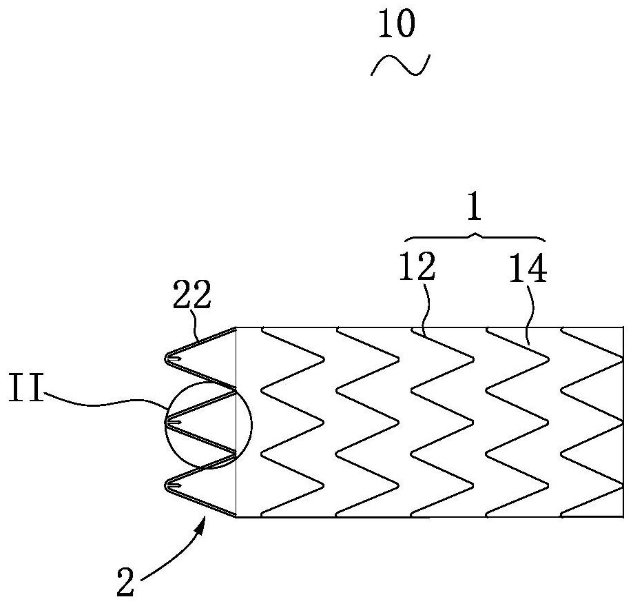 Lumen Stent Delivery Devices and Systems