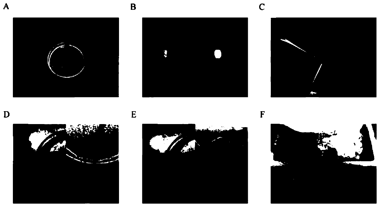 Production method and application of bladder urothelium single-cell suspension used for single-cell sequencing