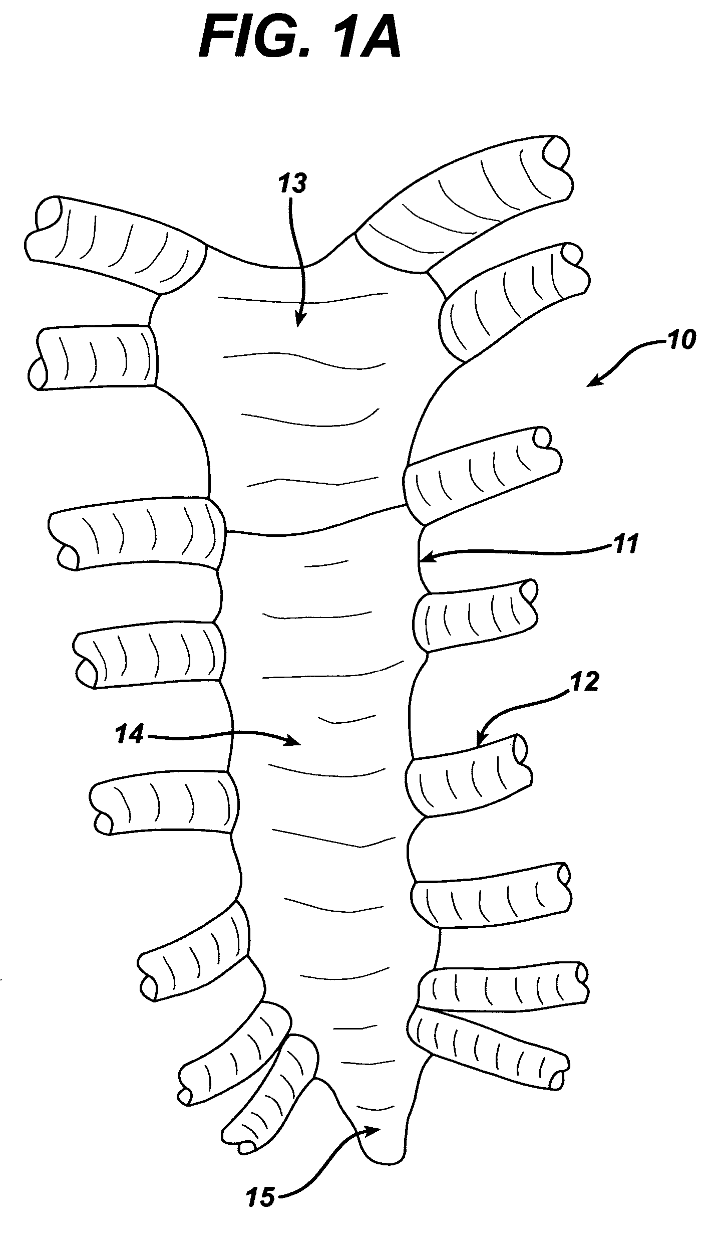 Sternal closure device and method