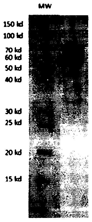 Development and application of tumor treatment agent containing antibody