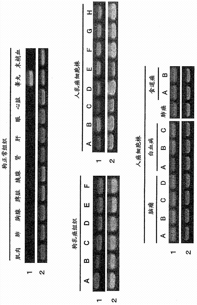 Pharmaceutical composition for treatment and/or prevention of cancer