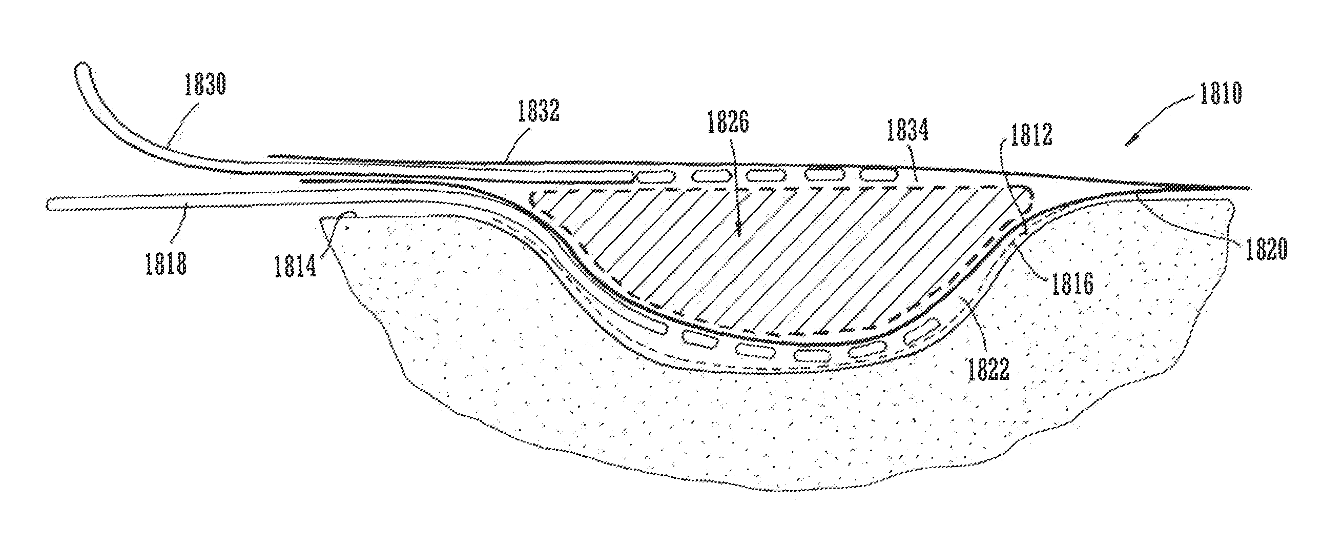 Wound filling apparatuses and methods