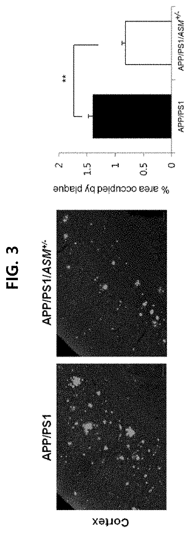 Method for treating a degenerative neurological disorders comprising administering asm inhibitor