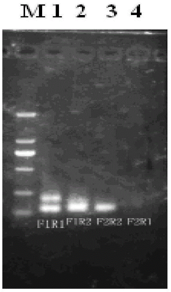 Double droplet type digital PCR absolute quantification detection kit for AIV H7N9 subtypes