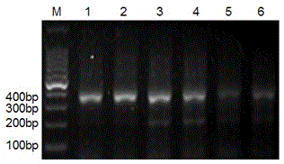 Leukemia single-chain antibody library, as well as construction method and application thereof