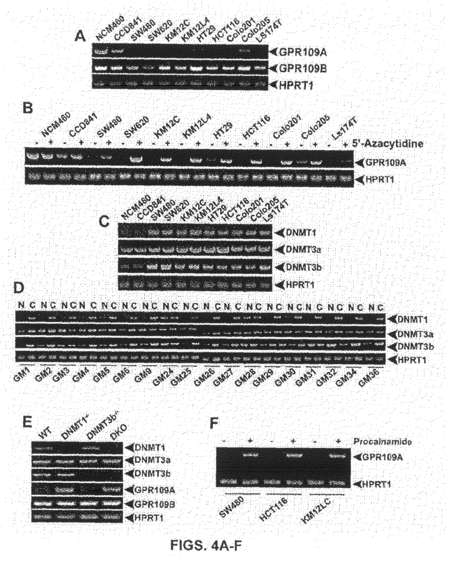 Compositions Comprising a GPR109 Ligand For Treating Disorders of the Digestive Tract and/or Cancer