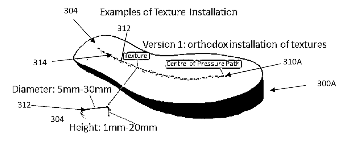 Injury reduction insole