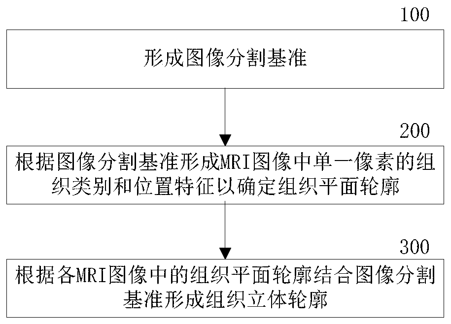 Segmentation method and segmentation system for large joint tissue