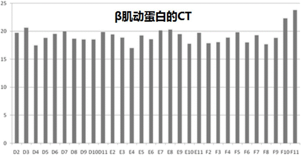 Cancer related gene expression difference detection kit and applications thereof