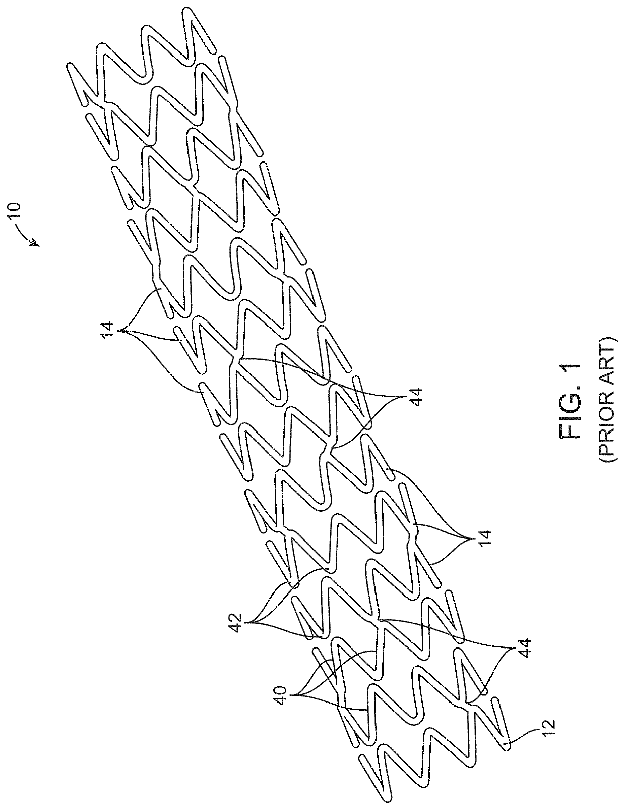 Uncaging stent