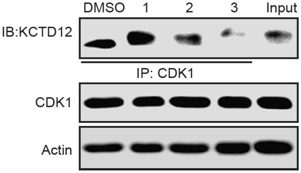 Application of adefovir dipivoxil in the preparation of antitumor drugs