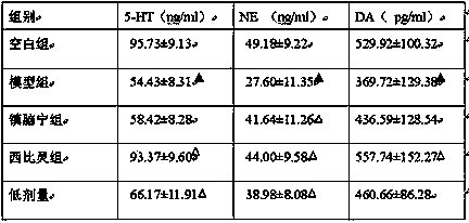 Traditional Chinese medicine compound preparation for treating migraine disease and preparation method thereof